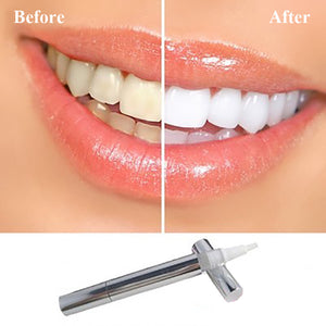Dental Stain Remover